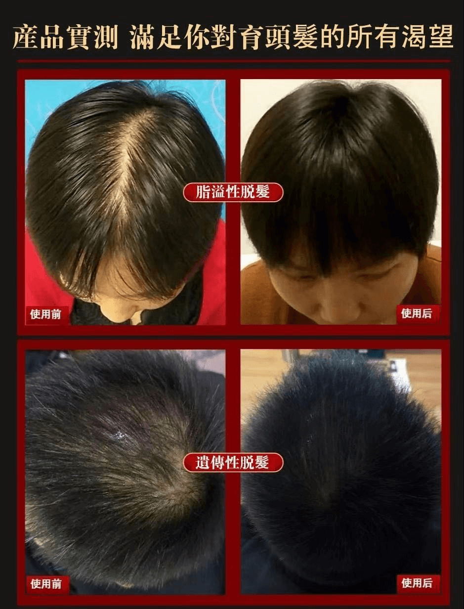 茜妃防脫育髮液