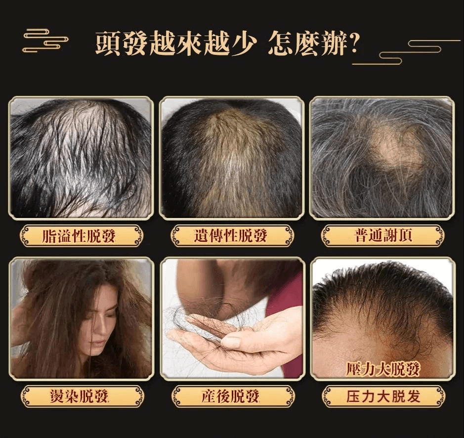 茜妃防脫育髮液