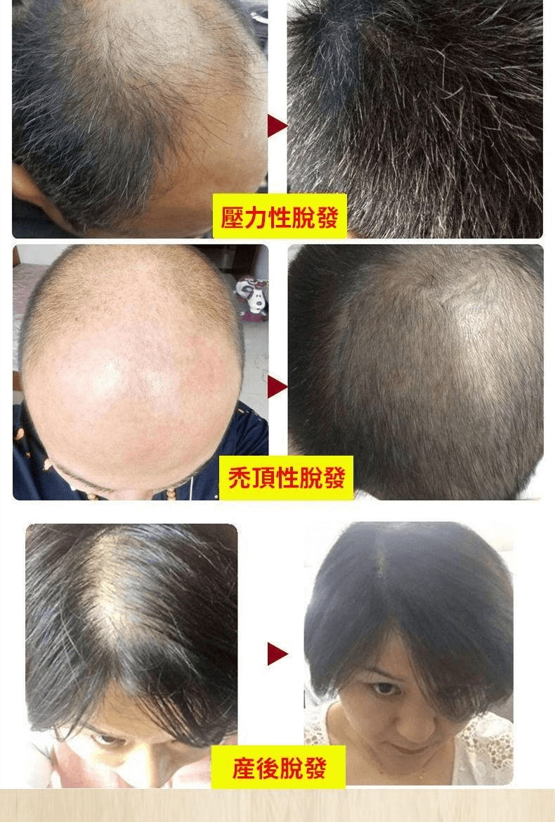 茜妃防脫育髮液