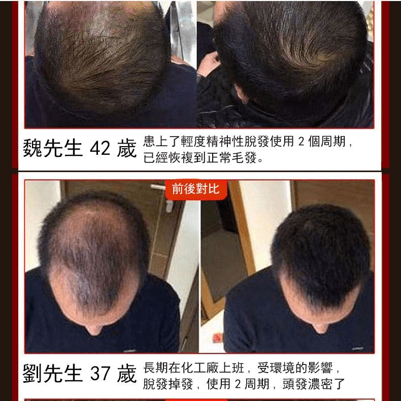 茜妃防脫育髮液