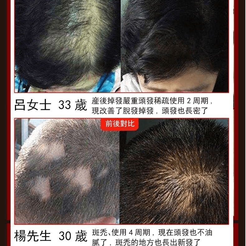 茜妃防脫育髮液